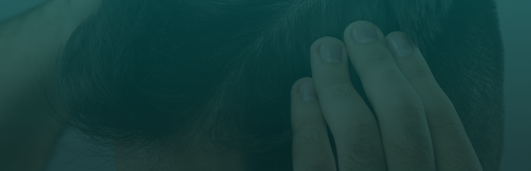 Artas® Robotic Hair Transplant