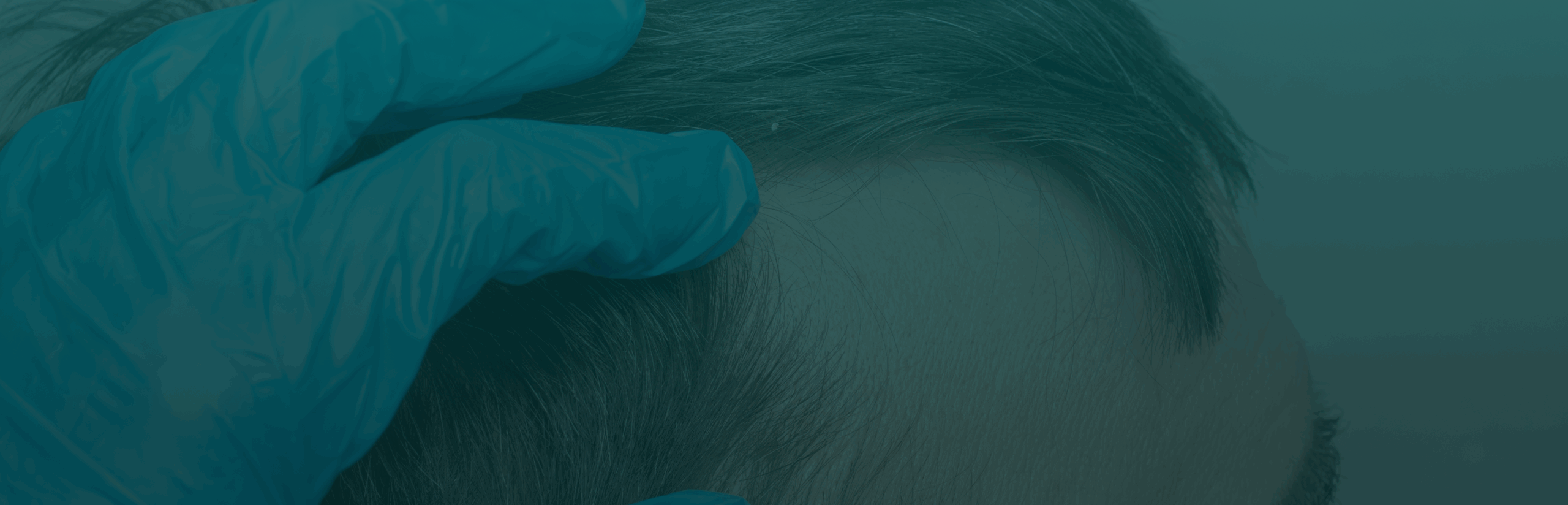 What to expect from your hair restoration consultation