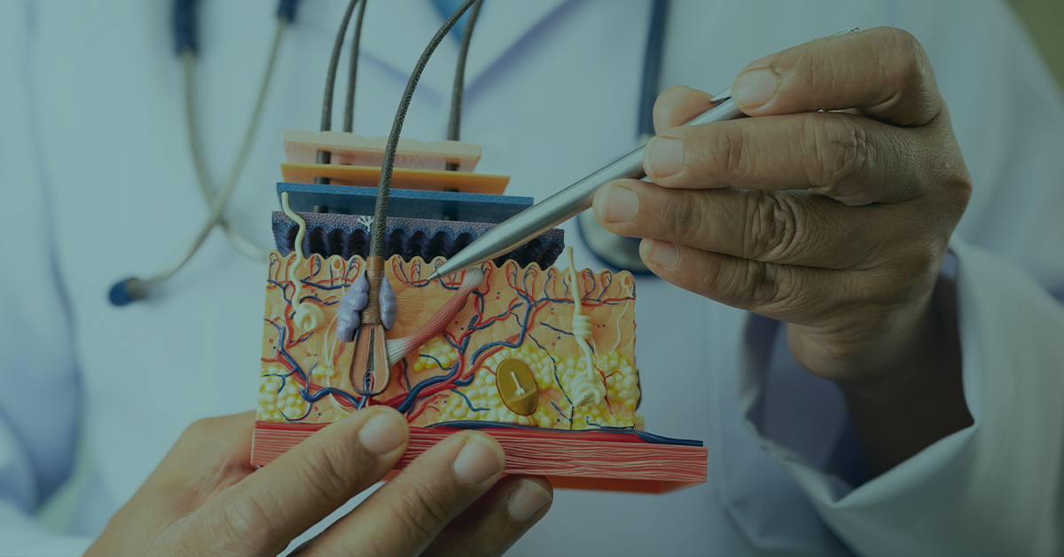 Diagram of the hair follicle