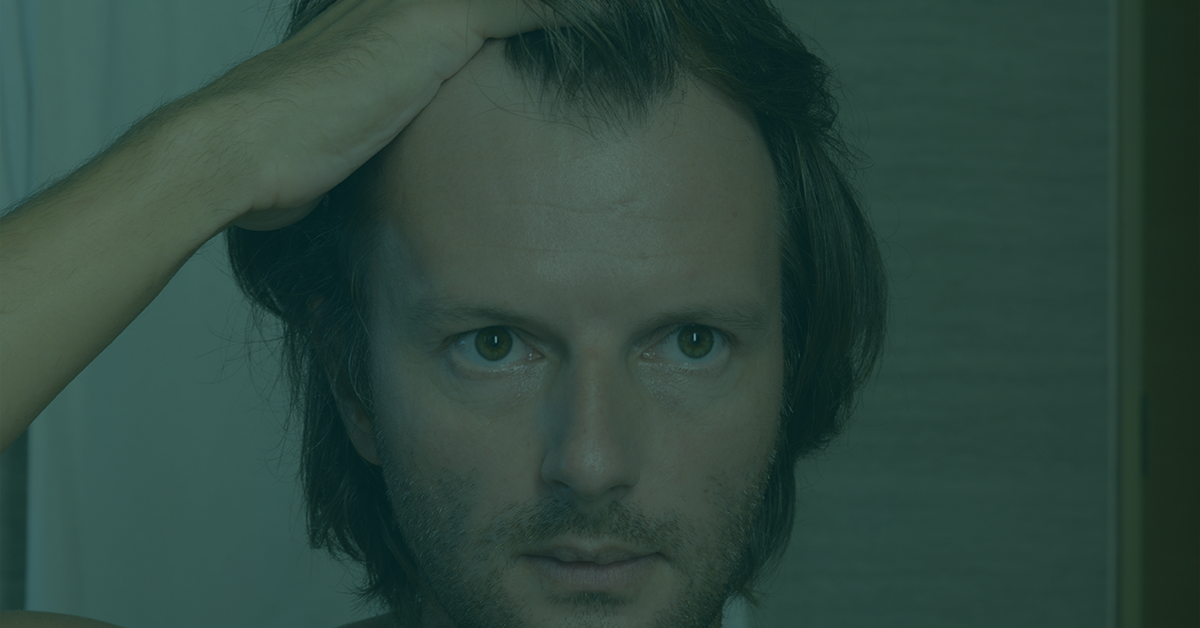 Man with receding hairline