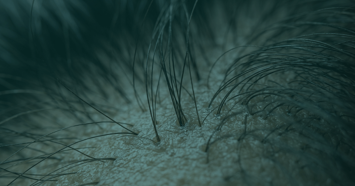 Closeup of scalp and hair.