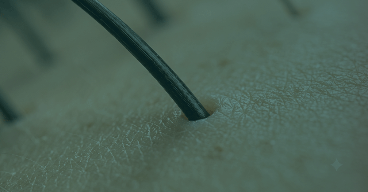 Closeup of a hair growing.